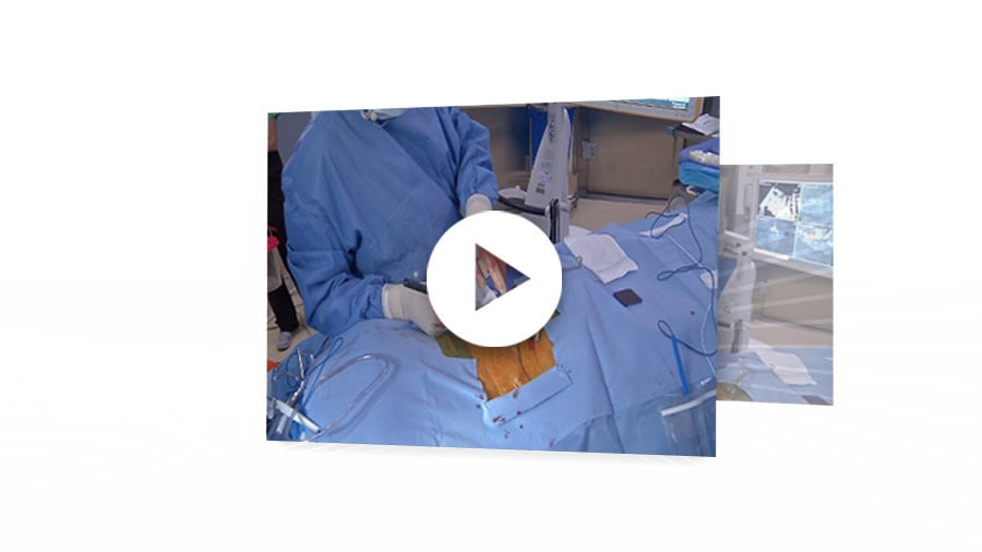AO Spine Videos